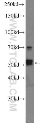 IRAK4 Antibody in Western Blot (WB)