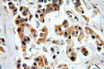 CHST3 Antibody in Immunohistochemistry (Paraffin) (IHC (P))