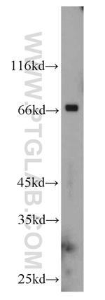 CHST3 Antibody in Western Blot (WB)