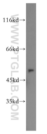 GSR Antibody in Western Blot (WB)