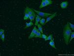 PHLDA1 Antibody in Immunocytochemistry (ICC/IF)