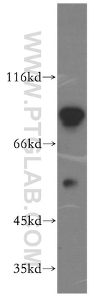 DDX19B Antibody in Western Blot (WB)