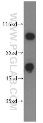 DDX19B Antibody in Western Blot (WB)