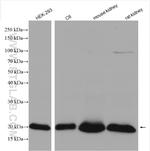 HRAS Antibody in Western Blot (WB)