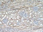 HRAS Antibody in Immunohistochemistry (Paraffin) (IHC (P))