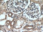 HRAS Antibody in Immunohistochemistry (Paraffin) (IHC (P))