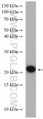 HRAS Antibody in Western Blot (WB)