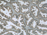 HRAS Antibody in Immunohistochemistry (Paraffin) (IHC (P))