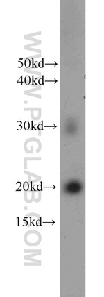 HRAS Antibody in Western Blot (WB)