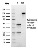 Desmoglein-3 Antibody in SDS-PAGE (SDS-PAGE)