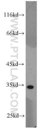 MRPL15 Antibody in Western Blot (WB)