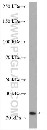 p35 Antibody in Western Blot (WB)