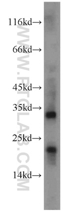 KISS1 Antibody in Western Blot (WB)