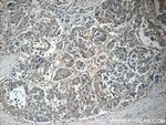 CACNG1 Antibody in Immunohistochemistry (Paraffin) (IHC (P))