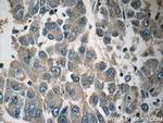 CACNG1 Antibody in Immunohistochemistry (Paraffin) (IHC (P))