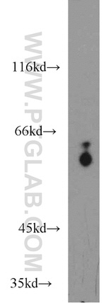 PSAP Antibody in Western Blot (WB)