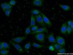 PSAP Antibody in Immunocytochemistry (ICC/IF)