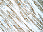 UQCRFS1 Antibody in Immunohistochemistry (Paraffin) (IHC (P))