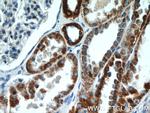 UQCRFS1 Antibody in Immunohistochemistry (Paraffin) (IHC (P))