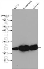 UQCRFS1 Antibody in Western Blot (WB)