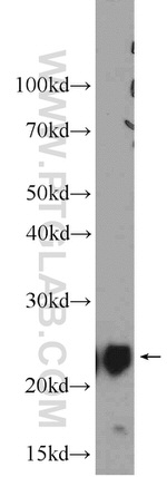 UQCRFS1 Antibody in Western Blot (WB)