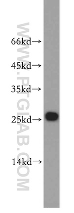 UQCRFS1 Antibody in Western Blot (WB)