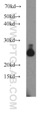 UQCRFS1 Antibody in Western Blot (WB)