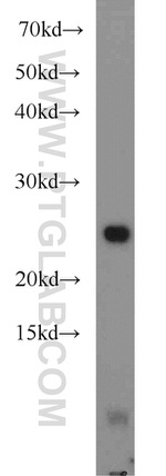 UQCRFS1 Antibody in Western Blot (WB)