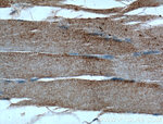 CLCN1 Antibody in Immunohistochemistry (Paraffin) (IHC (P))