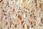 NUMB Antibody in Immunohistochemistry (Paraffin) (IHC (P))