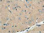 NUMB Antibody in Immunohistochemistry (Paraffin) (IHC (P))