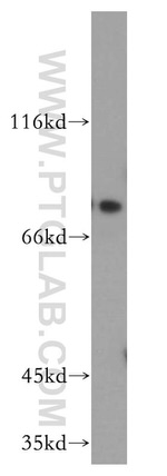 NUMB Antibody in Western Blot (WB)