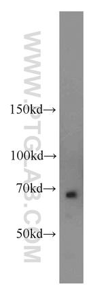 NUMB Antibody in Western Blot (WB)