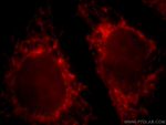 CPS1 Antibody in Immunocytochemistry (ICC/IF)