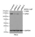 CPS1 Antibody in Western Blot (WB)