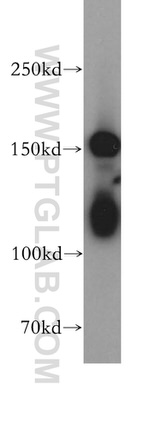 CPS1 Antibody in Western Blot (WB)