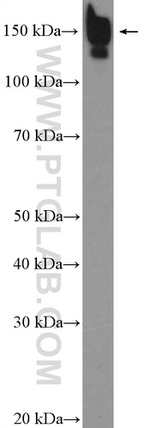 CPS1 Antibody in Western Blot (WB)