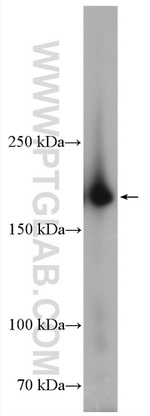 CD206 Antibody in Western Blot (WB)