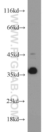 HOXD13 Antibody in Western Blot (WB)