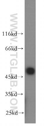 USP34 Antibody in Western Blot (WB)