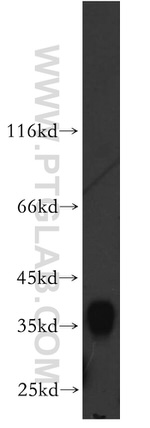 AKR1C4 Antibody in Western Blot (WB)