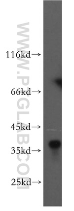 AKR1C4 Antibody in Western Blot (WB)