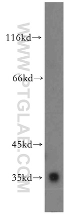 AKR1C4 Antibody in Western Blot (WB)