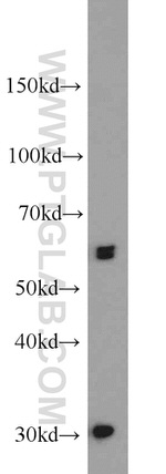 UBR2 Antibody in Western Blot (WB)