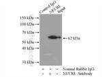 NEURL Antibody in Immunoprecipitation (IP)