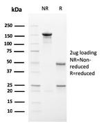 IgA Secretory Component/ECM1 Antibody in SDS-PAGE (SDS-PAGE)