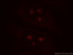 TXK Antibody in Immunocytochemistry (ICC/IF)