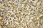 TXK Antibody in Immunohistochemistry (Paraffin) (IHC (P))