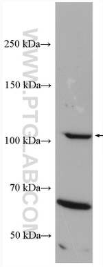 iNOS Antibody in Western Blot (WB)