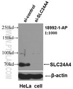 SLC24A4 Antibody in Western Blot (WB)